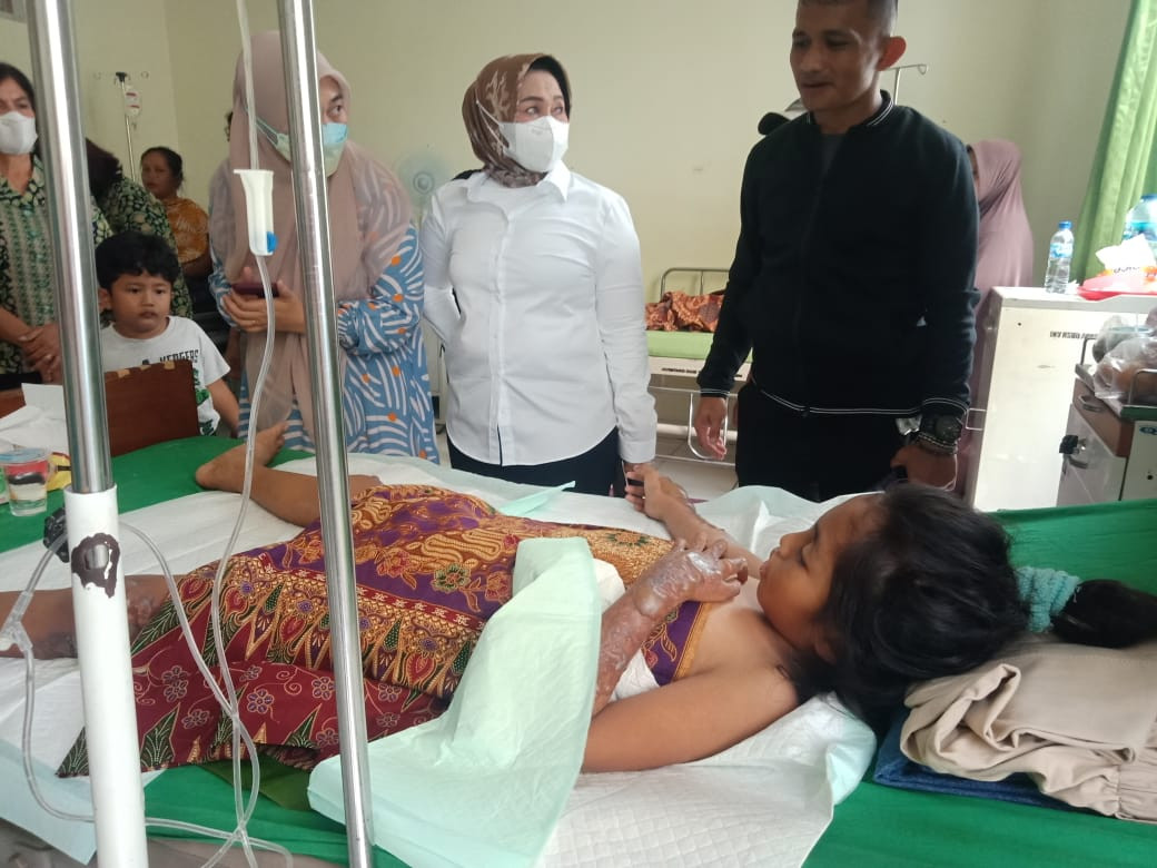 Dirawat Dirumah Sakit, Anggota DPRD Kuansing Melihat Korban Kebakaran