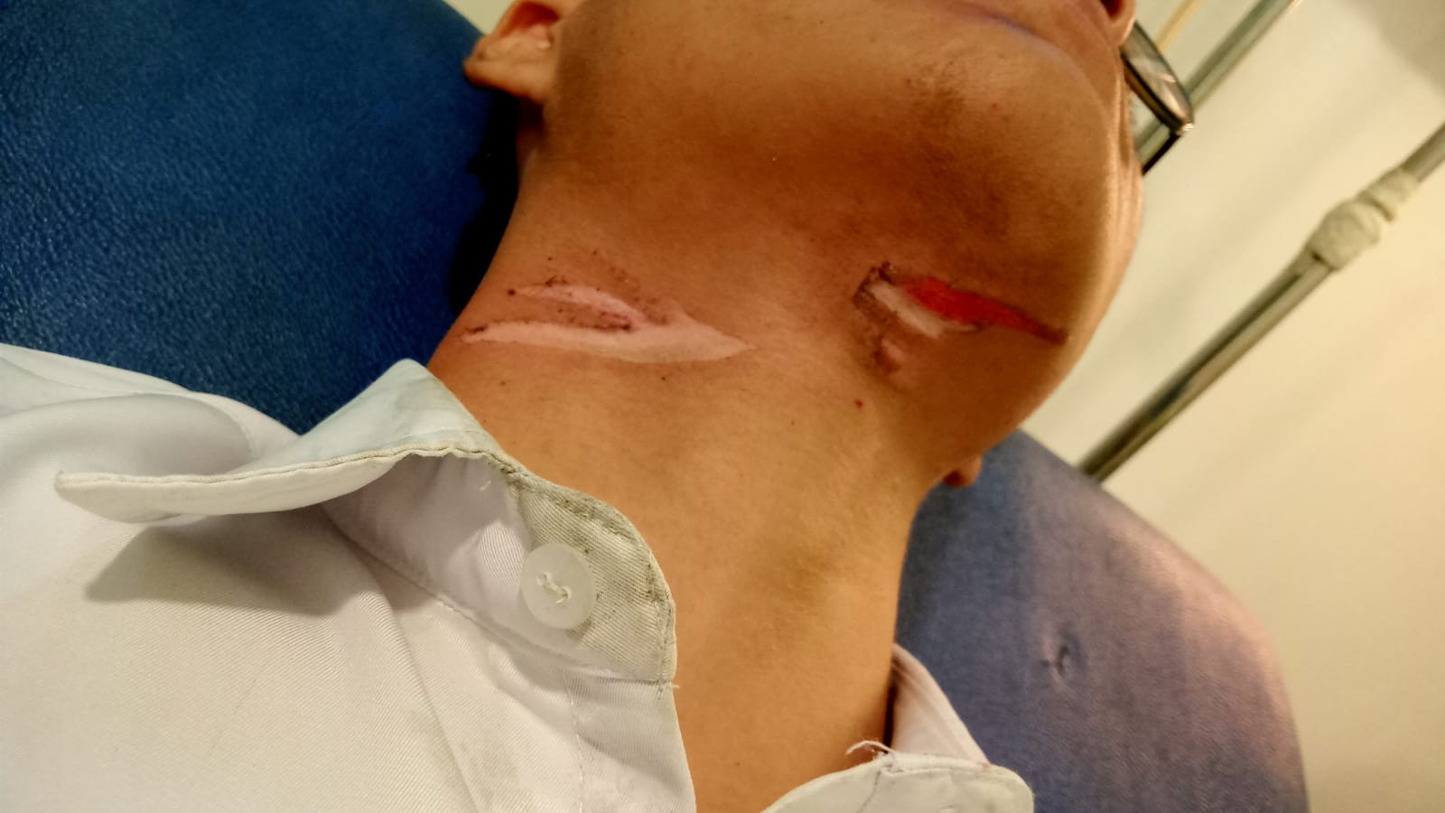 Dua Siswa  Jatuh Terjerat Kabel Yang Melintang di Tengah Jalan SM Amin Pekanbaru 